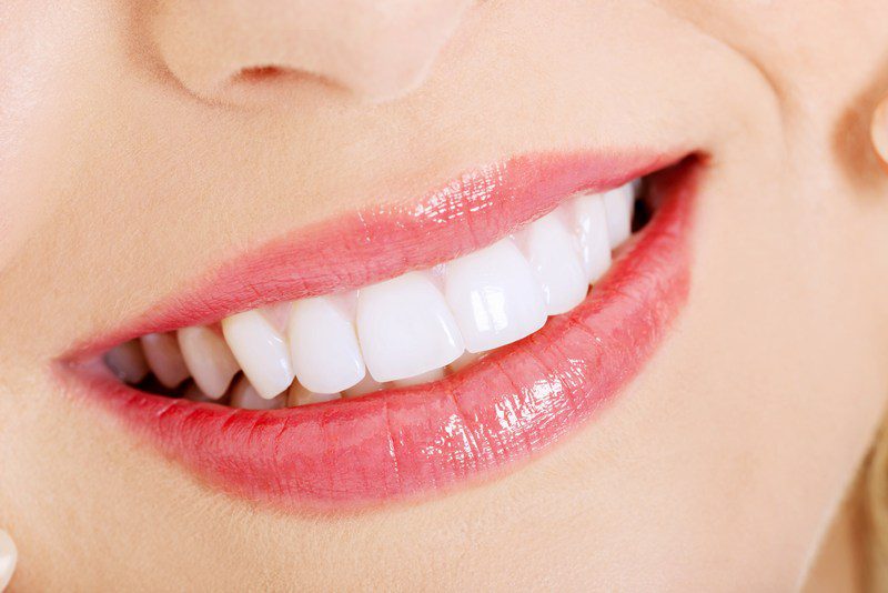 Cosmetic-Dentistry-Bonney-Lake-WA